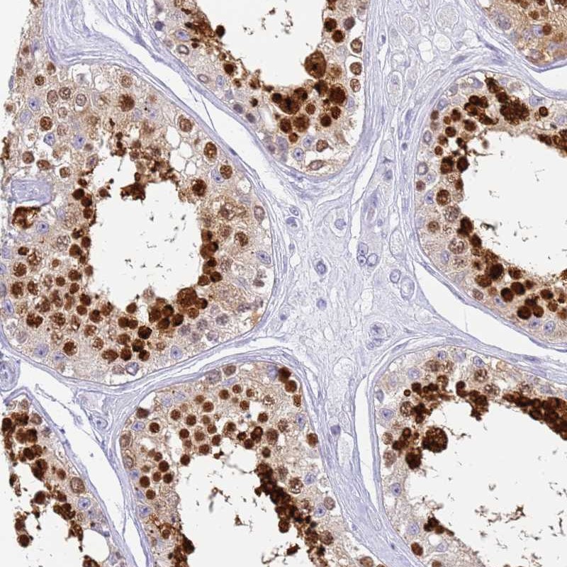 Anti-SNX20 Antibody