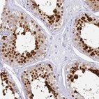 Anti-SNX20 Antibody