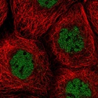 Immunofluorescent staining of human cell line A-431 shows localization to nucleoplasm.