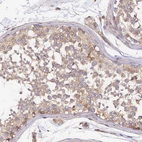 Immunohistochemical staining of human testis shows weak cytoplasmic and membranous positivity in cells in seminiferous ducts.