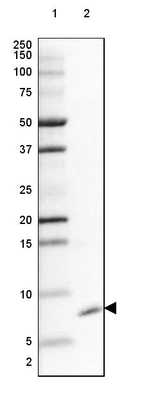 Lane 1: Marker [kDa] 250, 150, 100, 75, 50, 37, 25, 20, 15, 10, 5, 2_br/_Lane 2: Human cell line SK-MEL-30