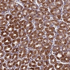 Anti-MRPL1 Antibody