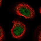 Immunofluorescent staining of human cell line A-431 shows localization to nucleoplasm.