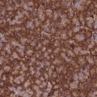 Anti-EXOC3L4 Antibody