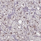 Anti-MRPL17 Antibody