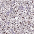 Anti-MRPL17 Antibody