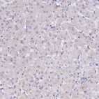 Anti-B3GNT8 Antibody