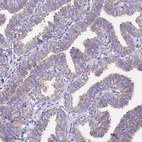 Anti-MRPL3 Antibody