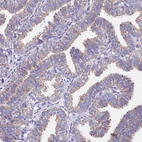 Anti-MRPL3 Antibody