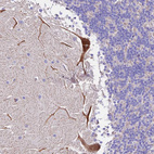 Immunohistochemical staining of human cerebellum shows moderate cytoplasmic positivity in Purkinje cells.