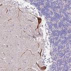 Immunohistochemical staining of human cerebellum shows moderate cytoplasmic positivity in Purkinje cells.