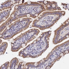 Immunohistochemical staining of human duodenum shows moderate cytoplasmic positivity in glandular cells.