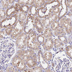 Immunohistochemical staining of human kidney shows moderate cytoplasmic positivity in cells in tubules.