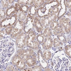 Immunohistochemical staining of human kidney shows moderate cytoplasmic positivity in cells in tubules.