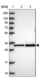 Lane 1: Marker [kDa] 250, 130, 95, 72, 55, 36, 28, 17, 10_br/_Lane 2: Human cell line RT-4_br/_Lane 3: Human cell line U-251MG sp