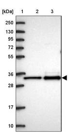 Lane 1: Marker [kDa] 250, 130, 95, 72, 55, 36, 28, 17, 10_br/_Lane 2: Human cell line RT-4_br/_Lane 3: Human cell line U-251MG sp