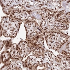 Immunohistochemical staining of human placenta shows strong nuclear positivity in trophoblastic cells.