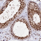 Immunohistochemical staining of human testis shows strong nuclear positivity in cells in seminiferous ducts.