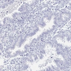 Anti-COL17A1 Antibody