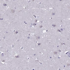 Immunohistochemical staining of human Cerebral cortex shows weak cytoplasmic positivity in neuronal cells.