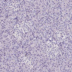 Anti-COL17A1 Antibody