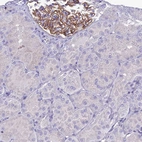 Immunohistochemical staining of human Kidney shows strong membranous positivity in cells in glomeruli.