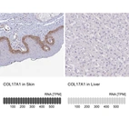 Immunohistochemistry analysis in human skin and liver tissues using HPA043673 antibody. Corresponding COL17A1 RNA-seq data are presented for the same tissues.
