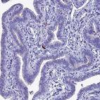 Immunohistochemical staining of human Fallopian tube shows weak positivity in apical membrane in glandular cells.