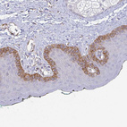 Anti-COL17A1 Antibody