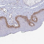 Immunohistochemical staining of human skin shows moderate membranous positivity in basal layer of epidermal cells.
