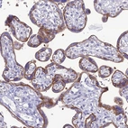 Immunohistochemical staining of human Placenta shows strong membranous positivity in trophoblastic cells.