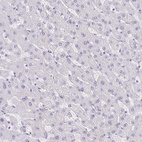 Anti-COL17A1 Antibody