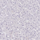 Immunohistochemical staining of human liver shows no positivity in hepatocytes as expected.