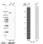 Western blot analysis in human cell lines A-431 and MCF-7 using Anti-COL17A1 antibody. Corresponding COL17A1 RNA-seq data are presented for the same cell lines. Loading control: Anti-GAPDH.