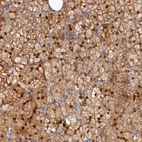 Anti-SPATA5L1 Antibody