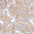 Immunohistochemical staining of human kidney shows moderate nuclear positivity in a small subset of cells in tubules.