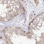 Immunohistochemical staining of human testis shows moderate nuclear positivity in a small subset of cells in seminiferous ducts.