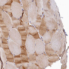Immunohistochemical staining of human skeletal muscle shows weak to moderate cytoplasmic positivity in myocytes.