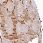 Immunohistochemical staining of human skeletal muscle shows weak to moderate cytoplasmic positivity in myocytes.