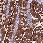 Anti-NLRP6 Antibody
