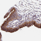 Anti-TUBA1A Antibody