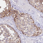 Immunohistochemical staining of human testis shows moderate cytoplasmic positivity in subset of cells in seminiferous ducts.