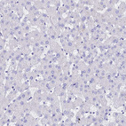 Immunohistochemical staining of human liver shows no positivity in hepatocytes as expected.