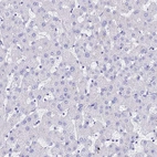 Immunohistochemical staining of human liver shows no positivity in hepatocytes as expected.