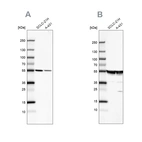 Western blot analysis using Anti-TUBA1A antibody HPA043684 (A) shows similar pattern to independent antibody HPA039247 (B).