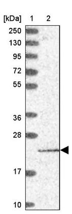 Lane 1: Marker [kDa] 250, 130, 95, 72, 55, 36, 28, 17, 10_br/_Lane 2: Human cell line RT-4