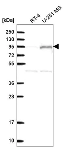 Western blot analysis in human cell line RT-4 and human cell line U-251 MG.