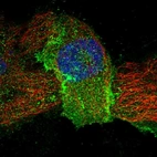 Immunofluorescent staining of human cell line A-431 shows localization to plasma membrane & cytosol.