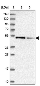 Lane 1: Marker [kDa] 250, 130, 95, 72, 55, 36, 28, 17, 10_br/_Lane 2: Human cell line RT-4_br/_Lane 3: Human cell line U-251MG sp
