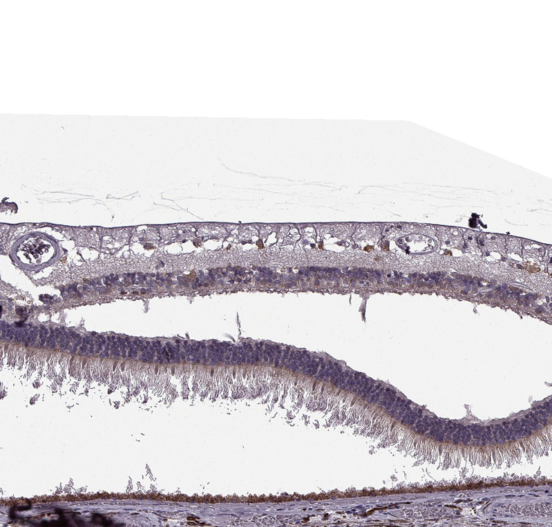 Anti-CABP5 Antibody